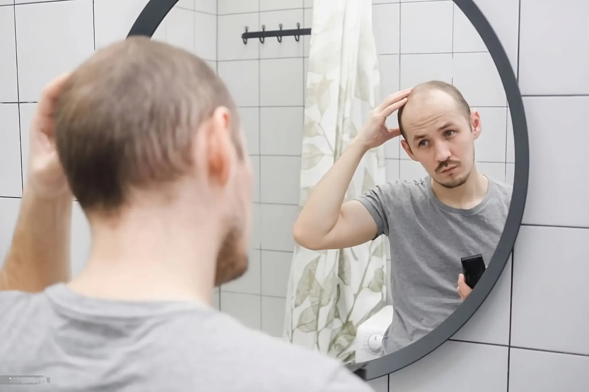 hair loss concern