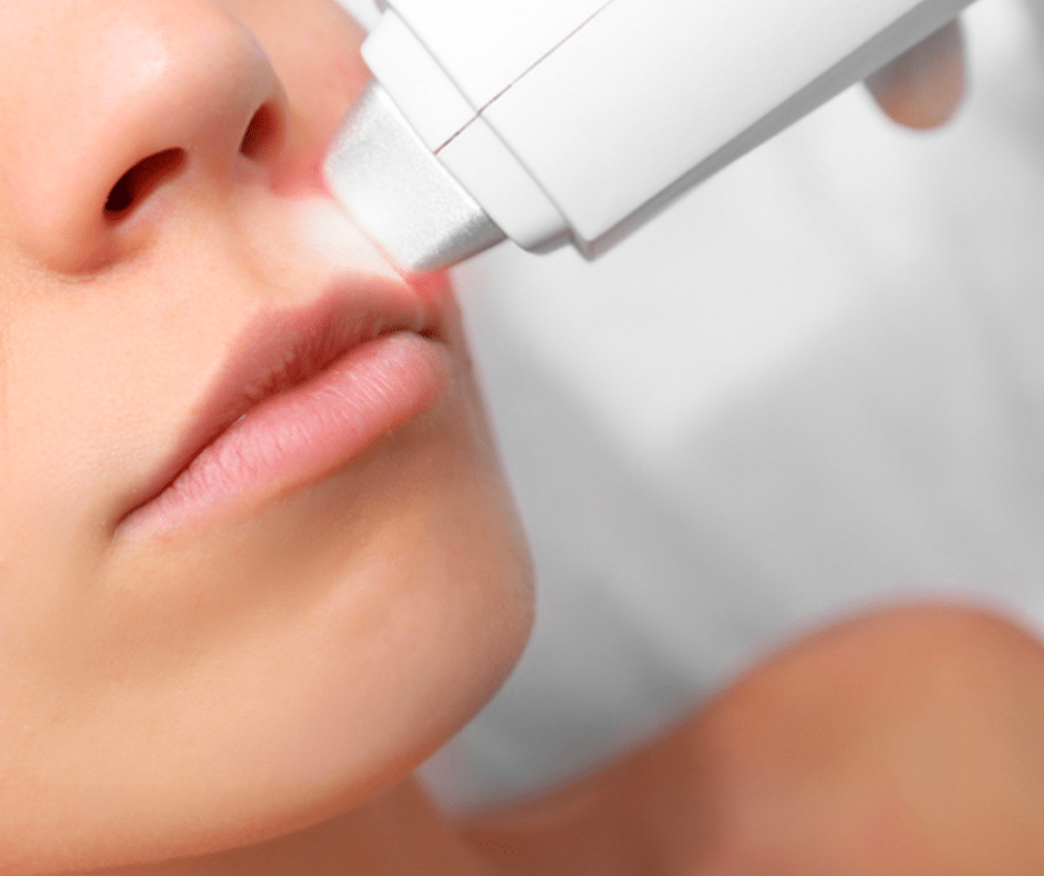 upper lip treatment