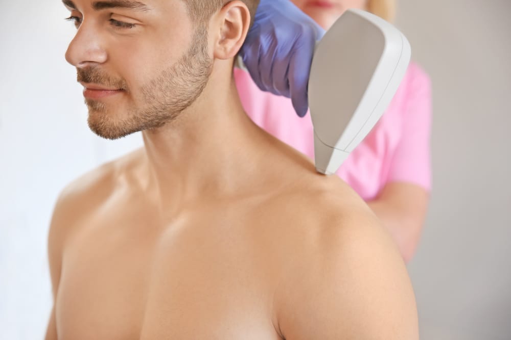 laser hair removal shoulders