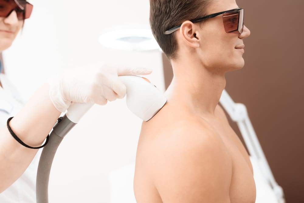 shoulder laser hair removal