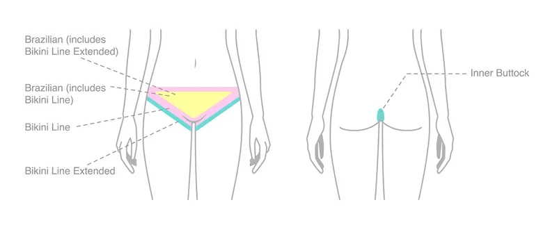 brazilian laser areas