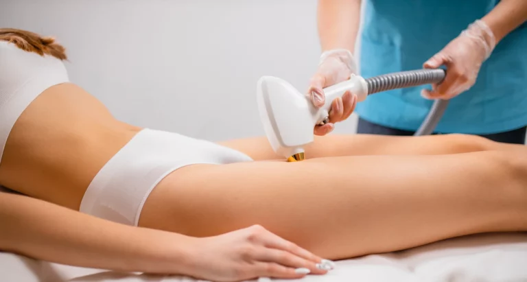 brazilian laser hair removal